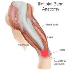 How do I fix Iliotibial Band Syndrome - San Diego Running & Sports