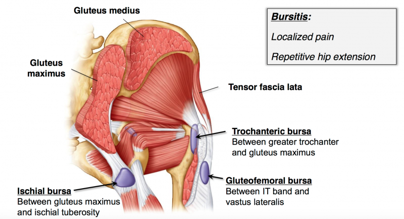 what-causes-butt-pain-gluteal-pain-san-diego-running-sports-injury