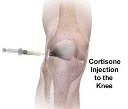 knee pain after cortisone shot